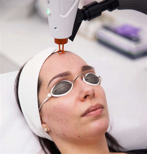 Laser Treatments - The One Clinic