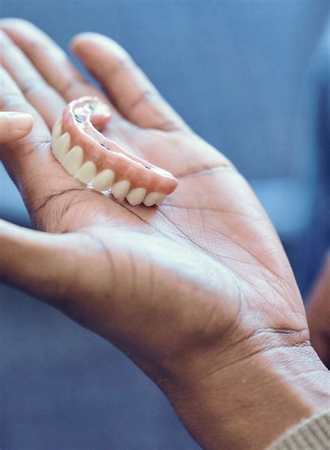 Implant dentures (also known as implant overdentures): Procedure guide