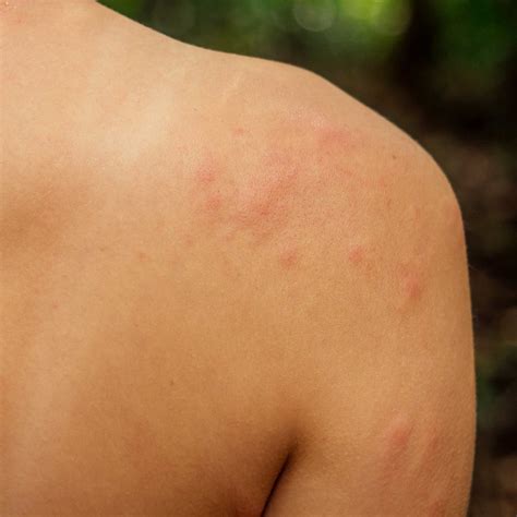 Stinging Insect Control – Amex Pest Management