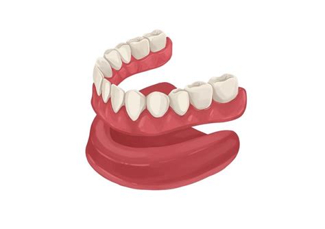 upper dentures  palate pros cons  procedure authority