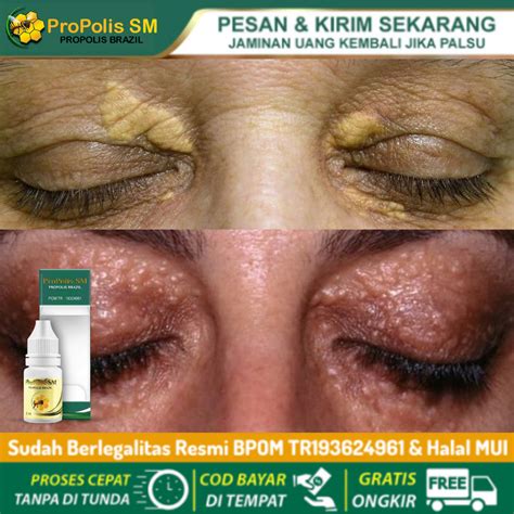 harga milia terbaru agustus  biggo indonesia