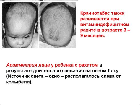 Анатомо-физиологические особенности костно-мышечной системы и их ...