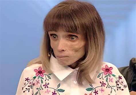 Кристина Корягина, которая весила 17 кг в 27 лет, показала, как ...