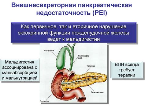 Хронический панкреатит. Диагностика и лечение - презентация онлайн