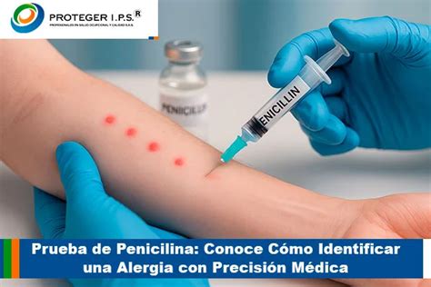 Alergia A Penicilina - Prueba de Penicilina: Conoce Cómo Identificar una Alergia con Precisión ...