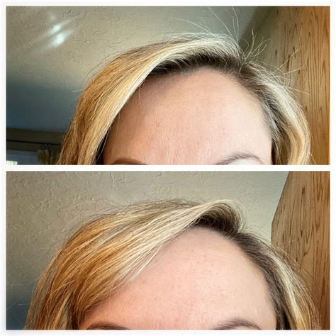 A hugely effective hair treatment for your frizzy flyaways – Sundry Buzz