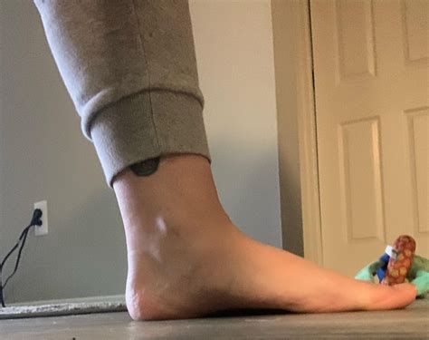 One of my feet has an arch and the other is totally flat. Always having