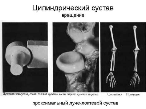 Суставы прерывные соединения или диартрозы Строение сустава
