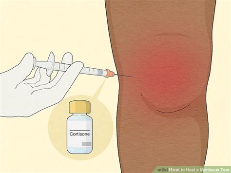 how long do meniscus tears take to heal
