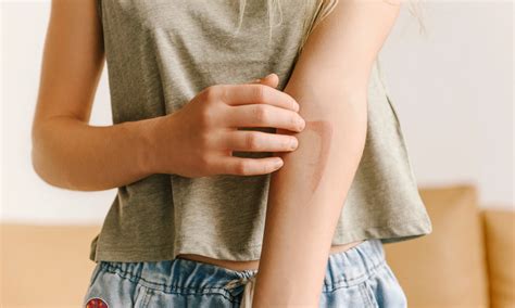 scar tissue star rehab strength training recovery physical therapy