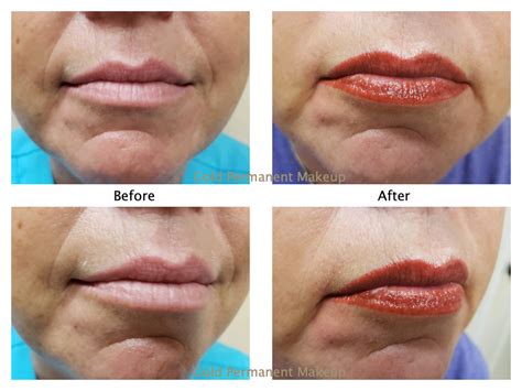 Permanent Makeup Lips Gone Wrong | Saubhaya Makeup