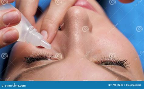 Attractive Girl Dripping Eye Drops, Introduces Them Under Eyelid into ...