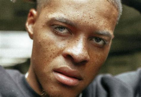 Black People Have Freckles, Too! Here’s The History Of Freckles, And ...