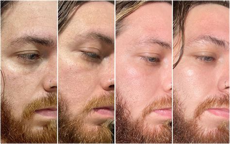Mix 01 Principia Antes E Depois - Principia Skincare: minha experiência e relação com a marca.