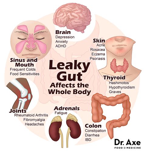 Leaky gut