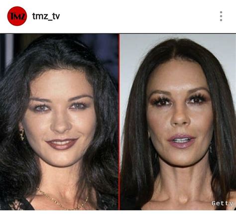 Catherine Zeta Jones Before And After