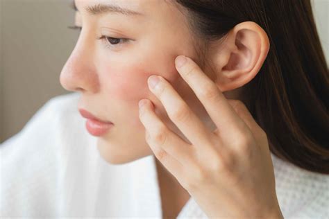 Ruddy Skin: Manage Redness & Improve Skin Tone | Pacific Derm
