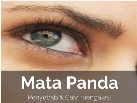 cara menghilangkan mata panda dan kerutan di bawah mata 4