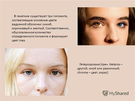 Презентация на тему: "Гетерохромия+ Триметиламинурия". Скачать ...