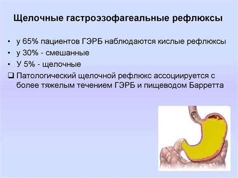 Гастроэзофагеальная рефлюксная болезнь - презентация онлайн