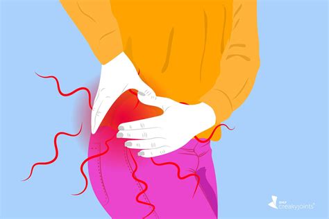 Arthritis in your hips early signs of hip arthritis and what to do