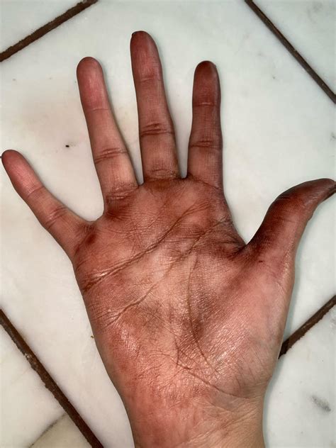How to remove permanent black hair dye from skin!!! : r/HairDye