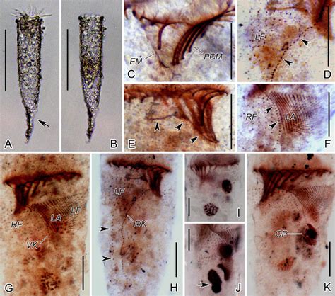 tintinnopsis radix  life     protargol
