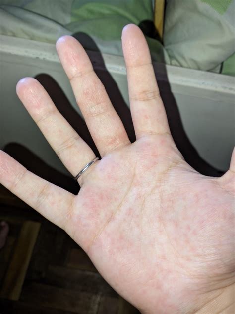 Desidrose : r/SkincareBR