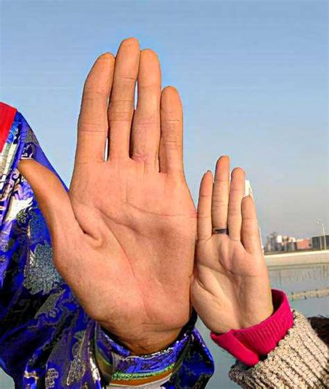 Bao Xishun: An Extremely Tall Man Without Gigantism - Malevus