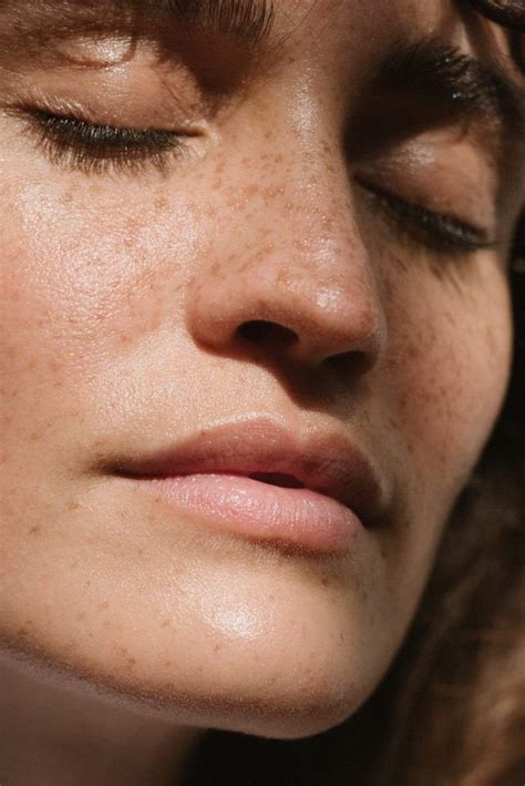The Practice — Pitney Dermatology