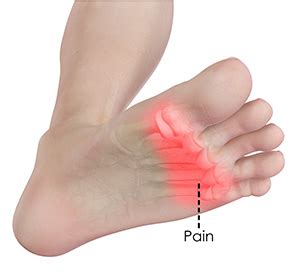 forefoot pain treatment lincoln ne big toe arthritis omaha toe