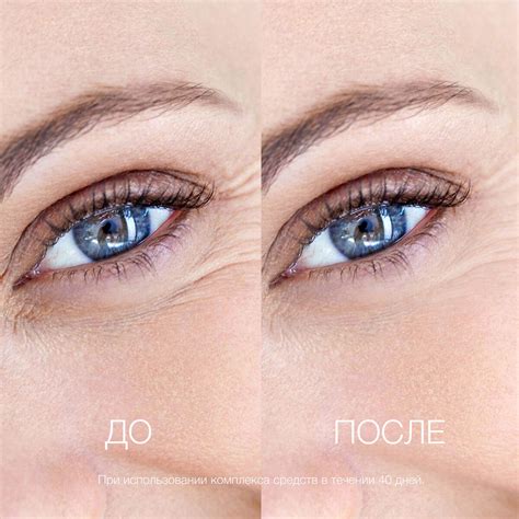 Эффективные средства против морщин вокруг глаз | ELDAN Cosmetics Russia ...