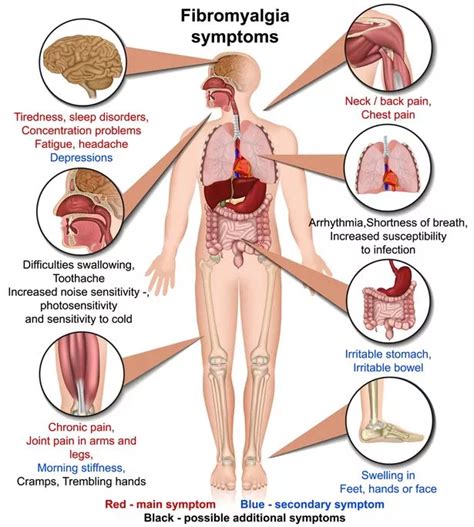 Huge rise in fibromyalgia in Grimsby area and nobody knows what causes ...