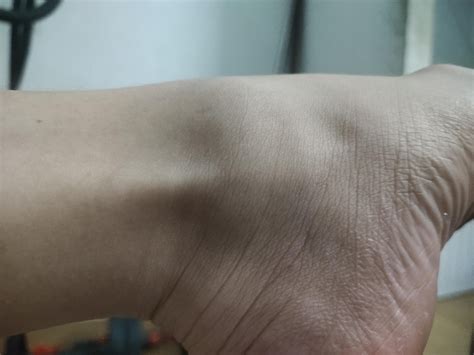 What is this tendon?I did too many calf raises and now it hurts right