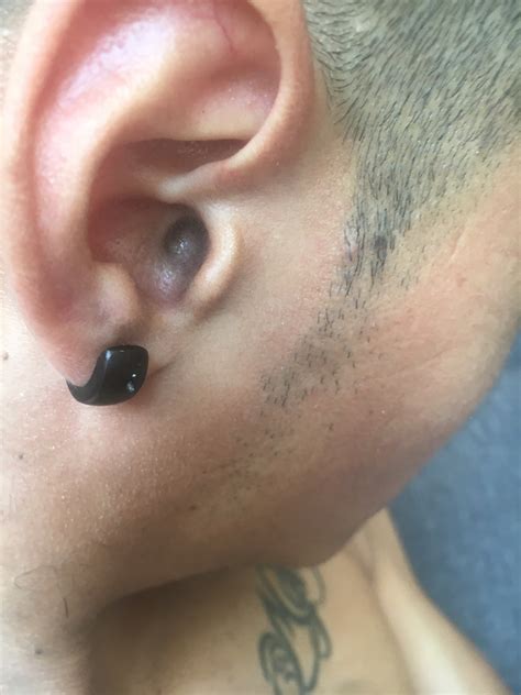 Golpe en el oído - Viviendo el sonido