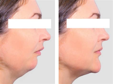 5 Ways To Breathe Life Into Your Definition