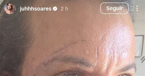 Como Ficou O Rosto Da Mulher Que Levou 60 Socos - Mulher agredida com 60 socos divulga foto do rosto após uma semana da ...
