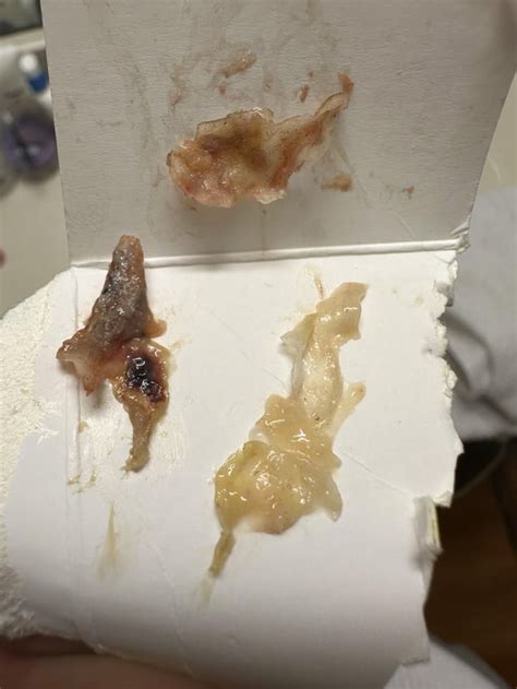One booger but it broke into 5 pieces (other 2 broke while trying to ...