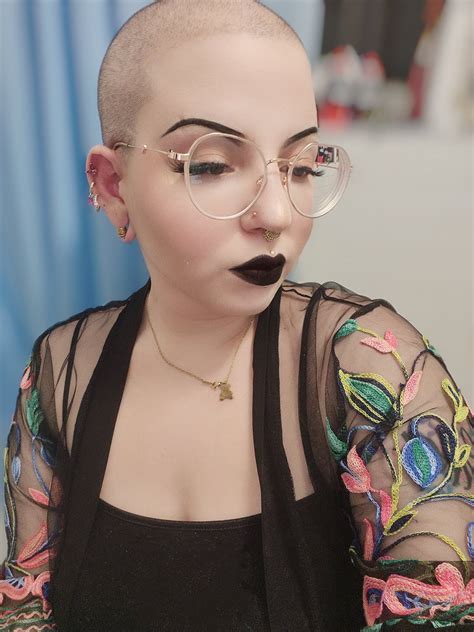 This is my glow up with androgenic alopecia and autoimmune diseases as