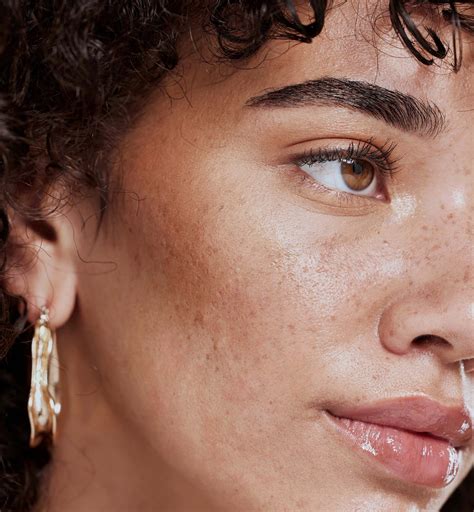 shorten  philtrum  harley st london