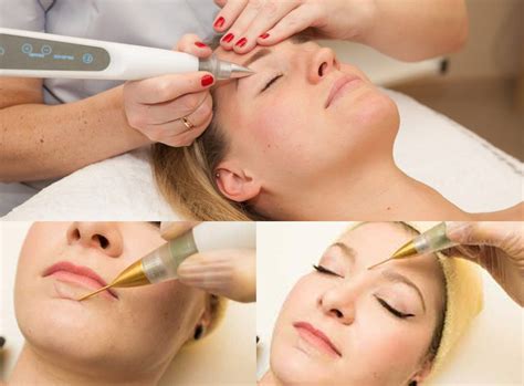 plasma laser mooi medical spa laser center