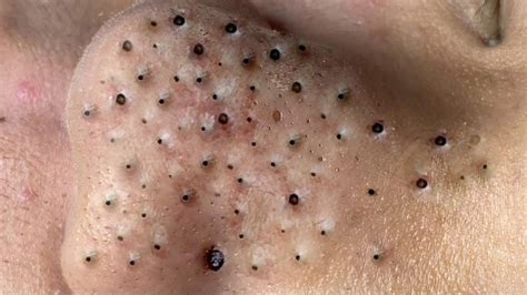 𝘐 𝘢𝘭𝘸𝘢𝘺𝘴 𝘭𝘪𝘬𝘦 𝘵𝘰 𝘭𝘰𝘰𝘬 𝘰𝘯 𝘵𝘩𝘦 𝘰𝘱𝘵𝘪𝘮𝘪𝘴𝘵𝘪𝘤 𝘴𝘪𝘥𝘦 𝘰𝘧 𝘭𝘪𝘧𝘦 - YouTube 