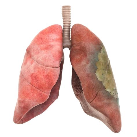 Premium Photo | Lungs disease infection concept 3d rendering