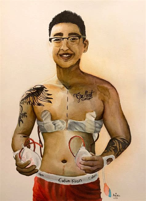 Trans Man After Top Surgery, Watercolor Painted by FTM Transgender