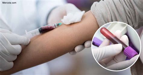 What Basic Blood Tests Can Tell You About Your Health