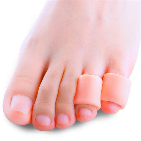 Pinky Toe Callus | ubicaciondepersonas.cdmx.gob.mx