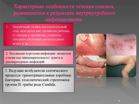 Сепсис новорожденных - презентация онлайн