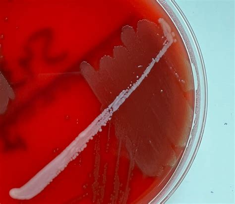 Streptococcus pneumoniae are lancet-shaped, gram-positive, facultative
