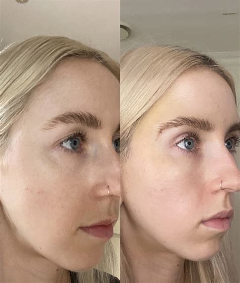 I got the viral fox eye lift and I wanted 'to die' from the pain