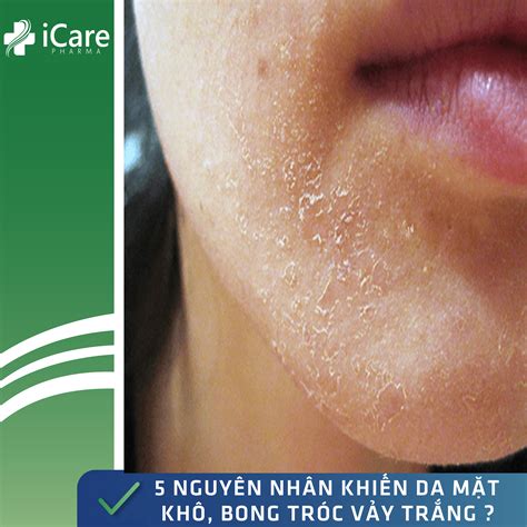 Tổng hợp hình ảnh các bệnh về da mặt để bác sĩ dễ nhận biết